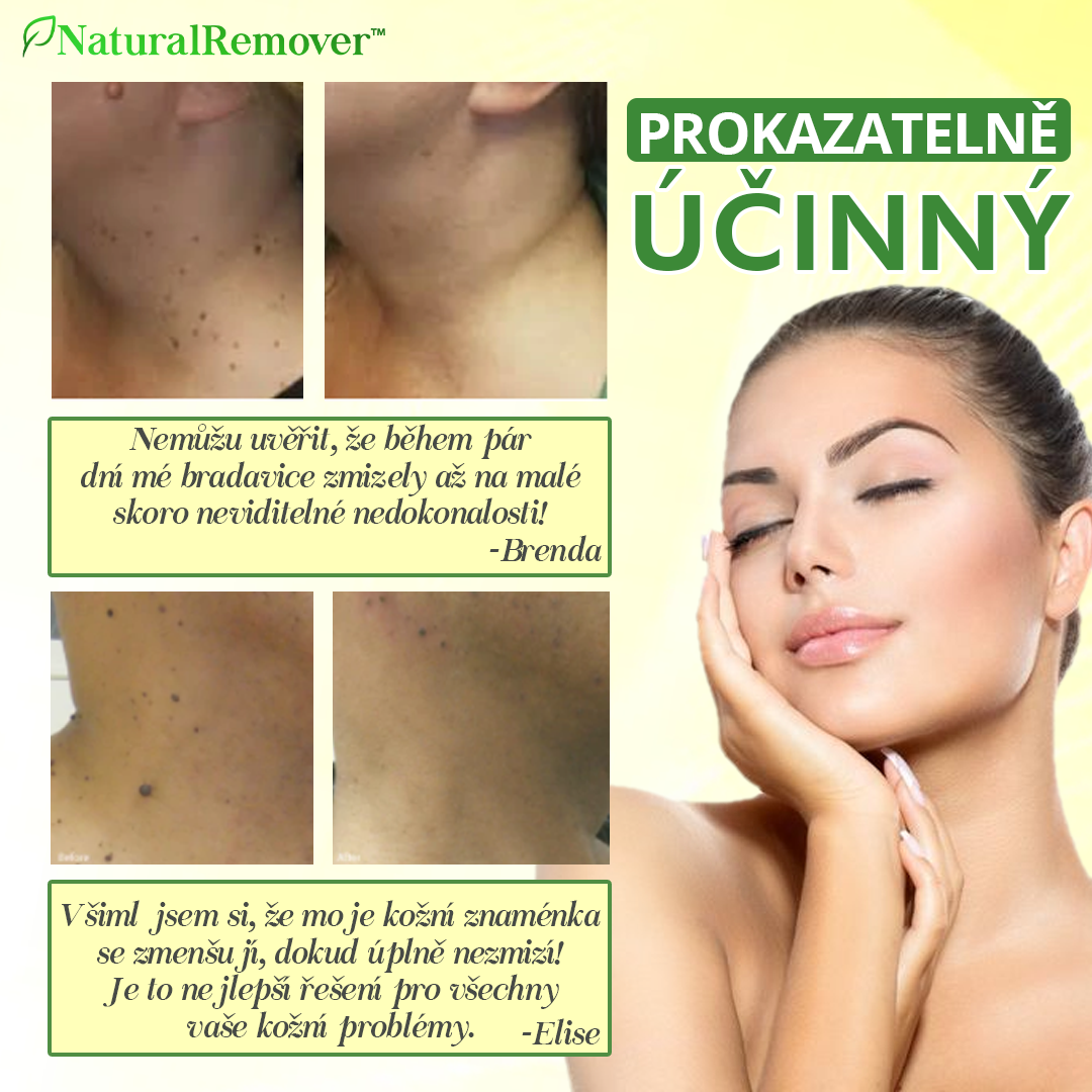NaturalRemover™ Odstraňovač Kožních Vad