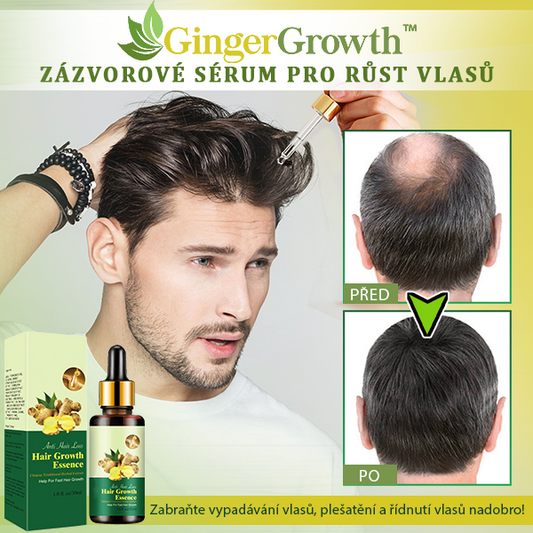 GingerGrowth™ Zázvorové Sérum Pro Růst Vlasů