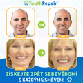 ToothRepair™
